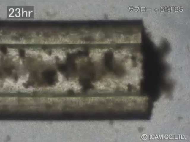 Part4_Candida_guilliermondii_Candida_krusei