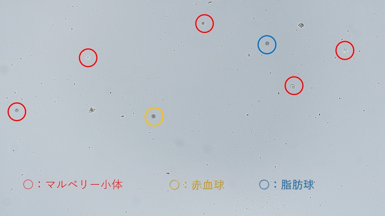 mulberry cell_Answer