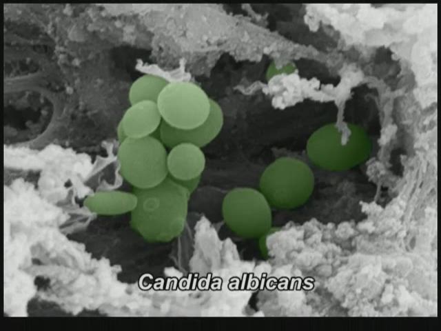 Part1_Candida_albicans