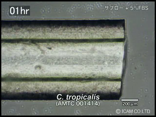 Part2_Candida_tropicalis