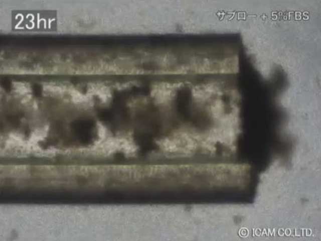 Part4_Candida_guilliermondii_Candida_krusei